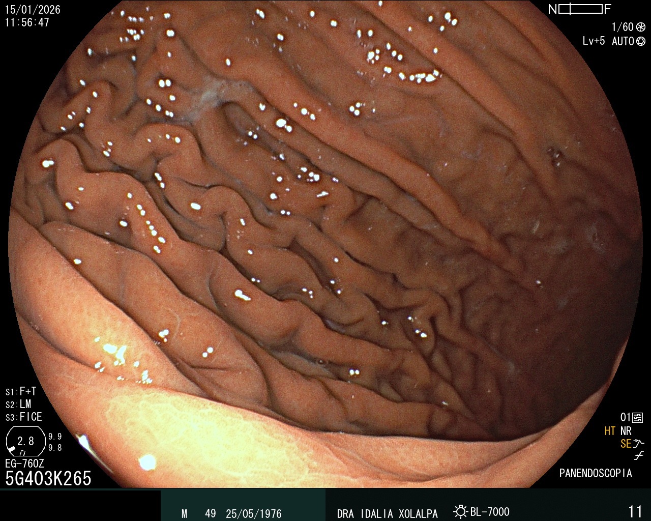 Estómago Normal - Caso clínico Dra. Idalia Xolalpa Nieto